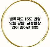 발목각도 15도 변형 있는 평발, 교정깔창 없이 좋아진 방법